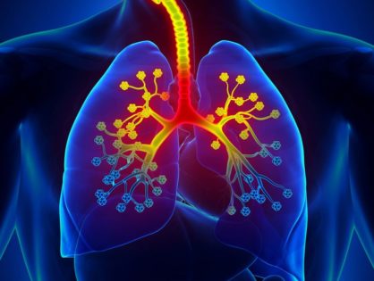 Astma. Leczenie i zapobieganie. Dieta, otoczenie i styl życia astmatyka